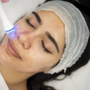 Korean Glass Facial Package of 4 Treatments