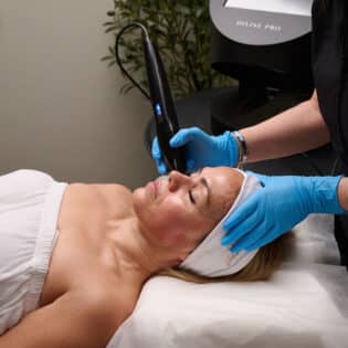 RF Needling Package of 4 Treatments