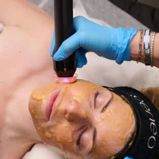 Oxygeneo Package of 4 Treatments